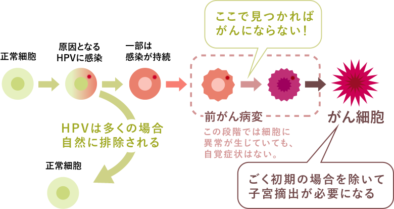 がんの進行状況